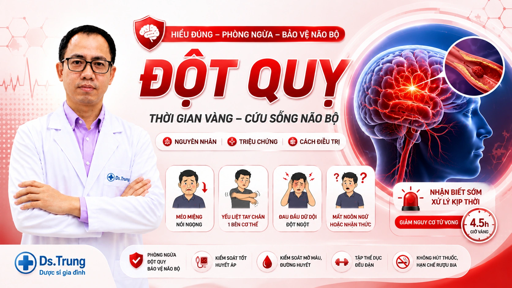 Đột quỵ: Nguyên nhân, Triệu chứng và cách Điều trị