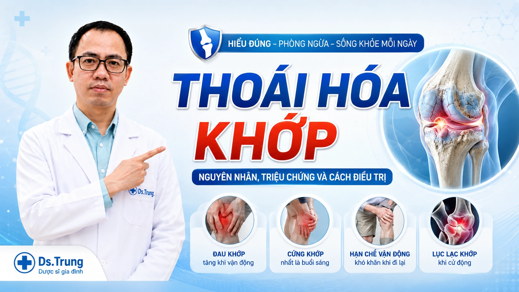 Thoái hóa khớp : Nguyên nhân, Triệu chứng và phương pháp Điều Trị